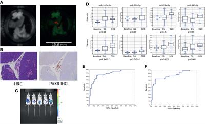 A Translational Model to Improve Early Detection of Epithelial <mark class="highlighted">Ovarian Cancers</mark>